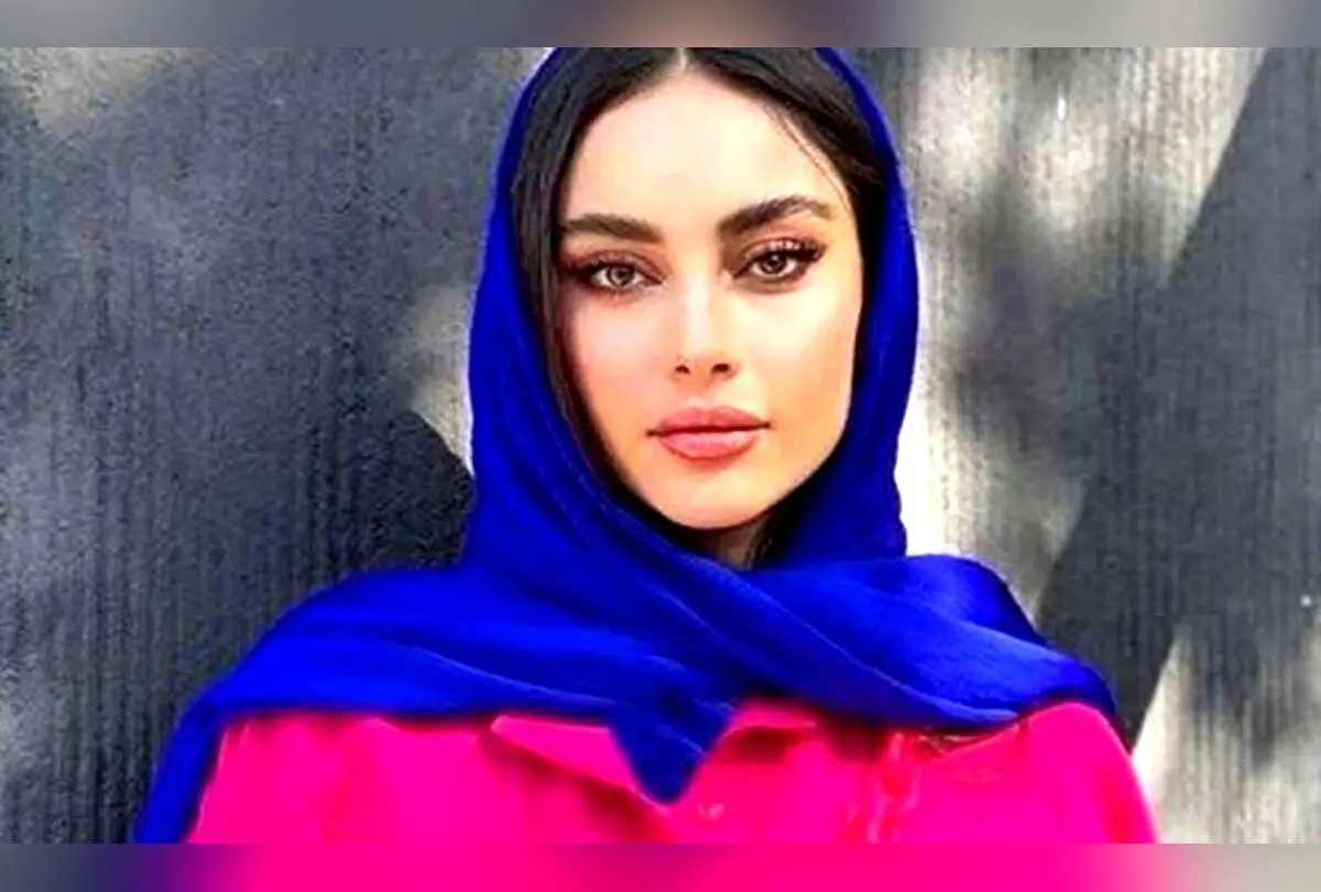 تغییر چشمگیر چهره ترلان پروانه؛ تصاویر قبل و بعد تحسین مخاطبان را برانگیخت