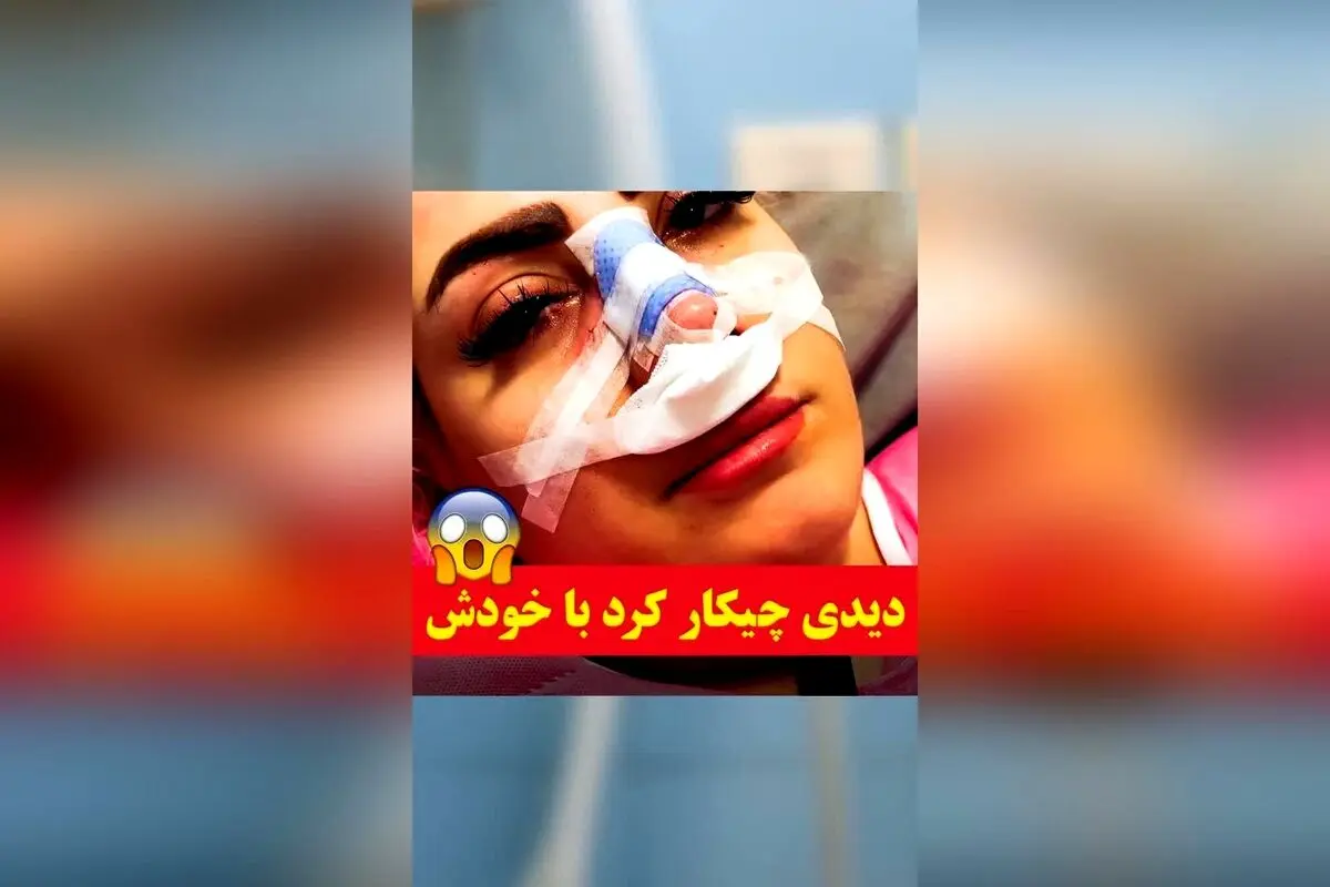 عمل جراحی بینی با فناوری اسکن و طراحی سه‌بعدی در طراح طب؛ قبل از عمل، نتیجه دلخواه خود را ببینید و استرس را کنار بگذارید