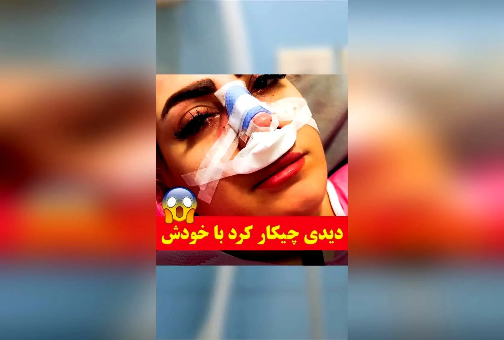 عمل جراحی بینی با فناوری اسکن و طراحی سه‌بعدی در طراح طب؛ قبل از عمل، نتیجه دلخواه خود را ببینید و استرس را کنار بگذارید