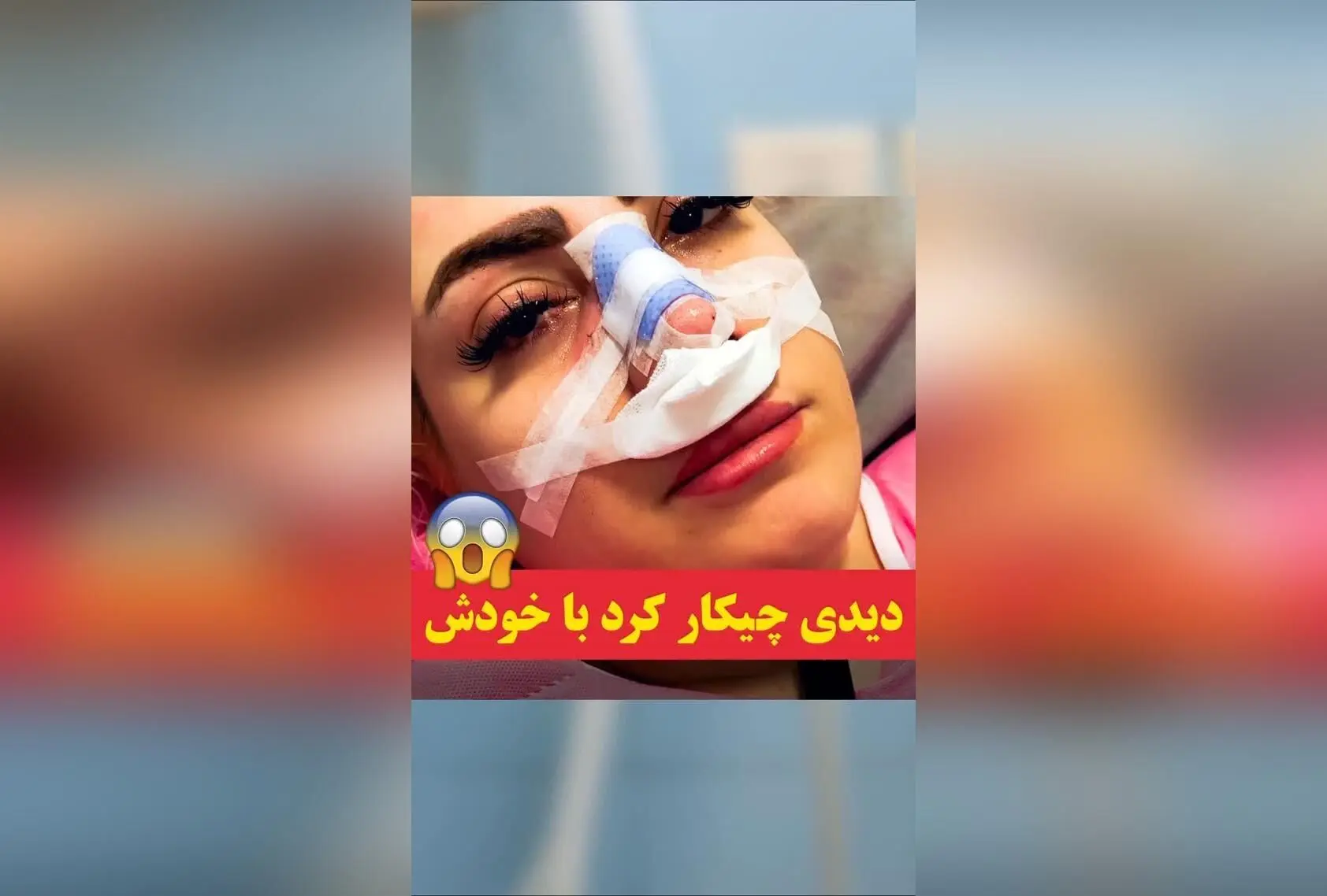 عمل جراحی بینی با فناوری اسکن و طراحی سه‌بعدی در طراح طب؛ قبل از عمل، نتیجه دلخواه خود را ببینید و استرس را کنار بگذارید