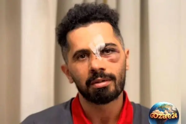 امید عالیشاه از محبت هواداران، بزرگ‌ترین انگیزه برای بازگشت به دنیای فوتبال پس از مصدومیت شدید