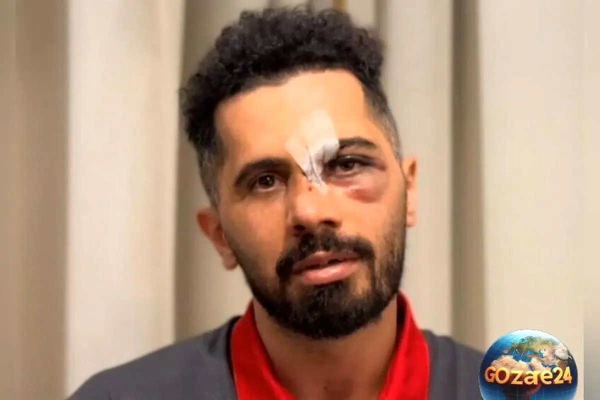 امید عالیشاه از محبت هواداران، بزرگ‌ترین انگیزه برای بازگشت به دنیای فوتبال پس از مصدومیت شدید