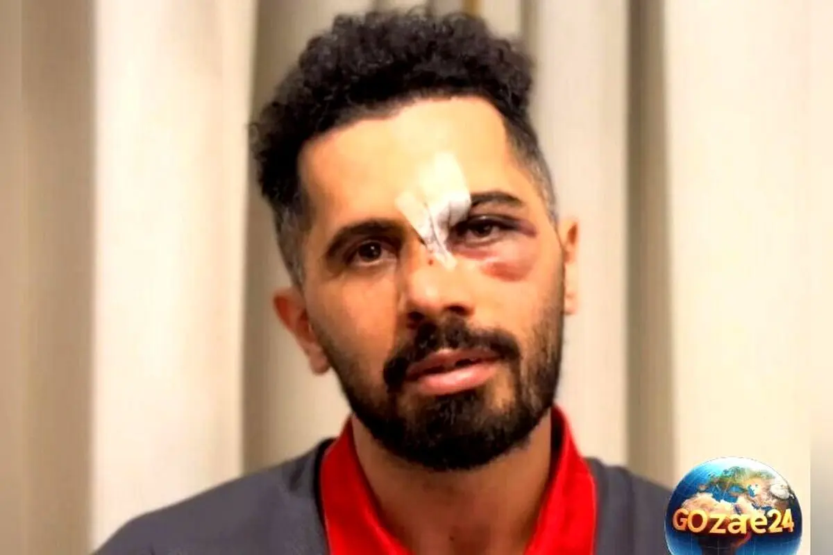 امید عالیشاه از محبت هواداران، بزرگ‌ترین انگیزه برای بازگشت به دنیای فوتبال پس از مصدومیت شدید
