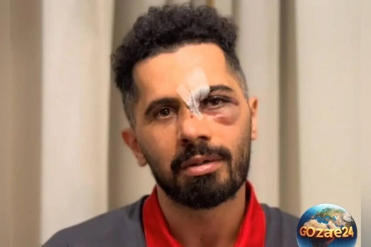 امید عالیشاه از محبت هواداران، بزرگ‌ترین انگیزه برای بازگشت به دنیای فوتبال پس از مصدومیت شدید