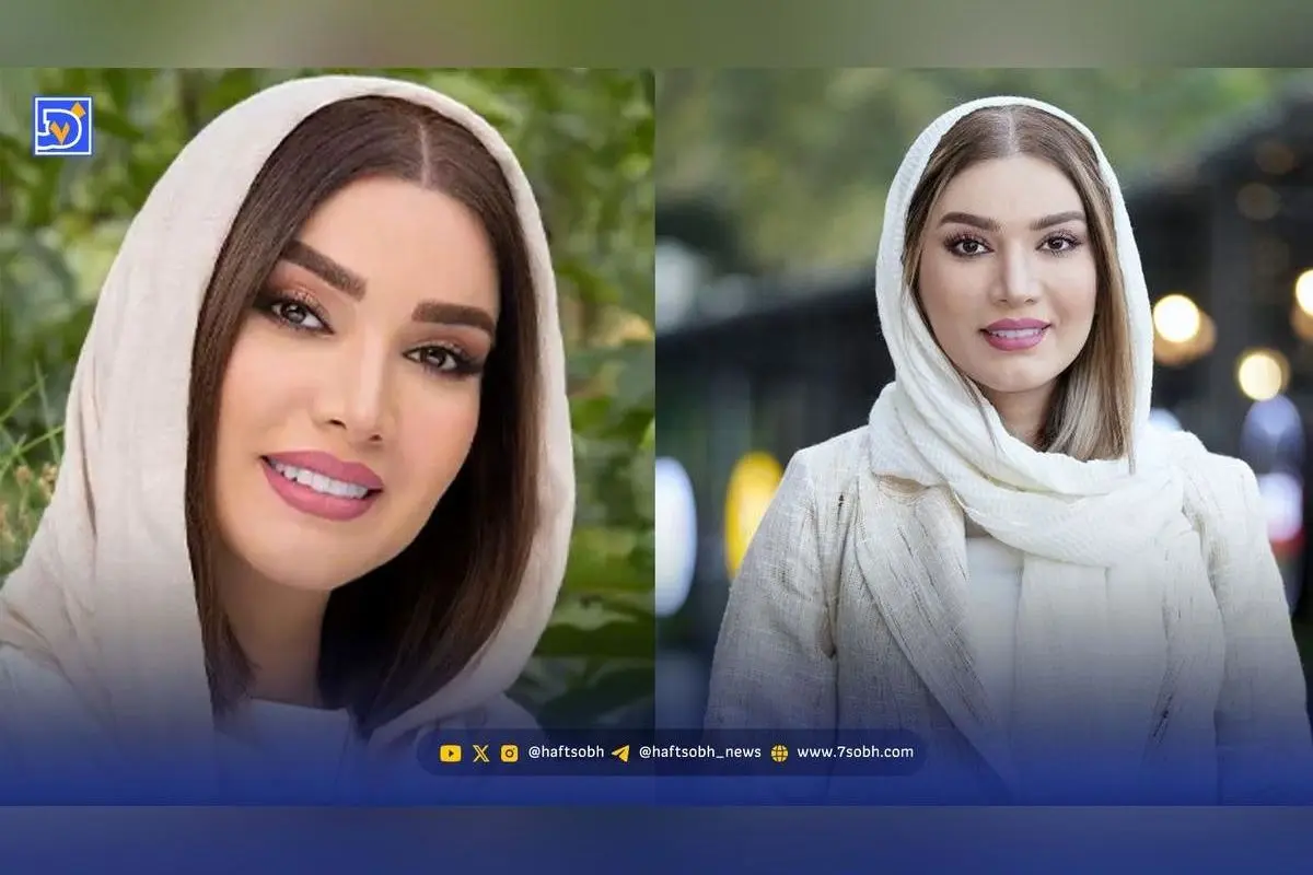 تصاویر قبل و بعد عمل زیبایی متین ستوده؛ تغییرات چشمگیر در چهره خانم بازیگر و رازهای جراحی زیبایی او