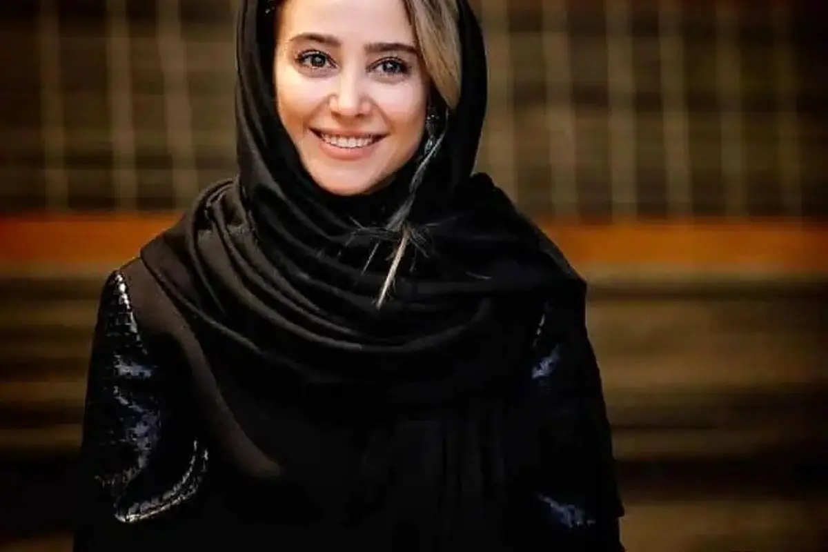 ناز حبیبی و تغییرات پوستش؛ چرا برنزه کردن به پوستش آسیب زده است؟