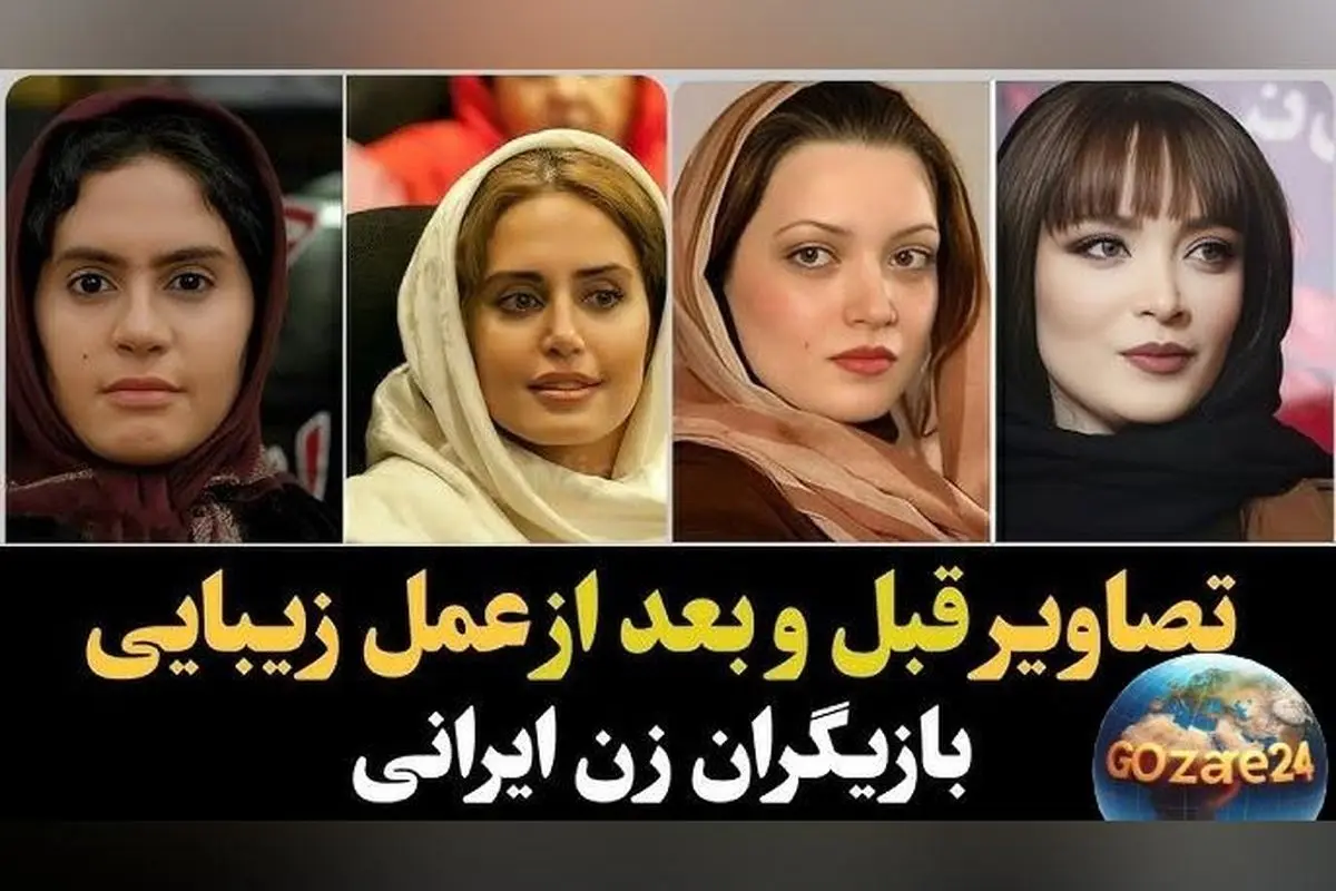 تغییر چهره بازیگران زن ایرانی قبل و بعد از عمل‌های زیبایی؛ تصاویر باورنکردنی و تحلیل روند زیبایی در سینمای ایران