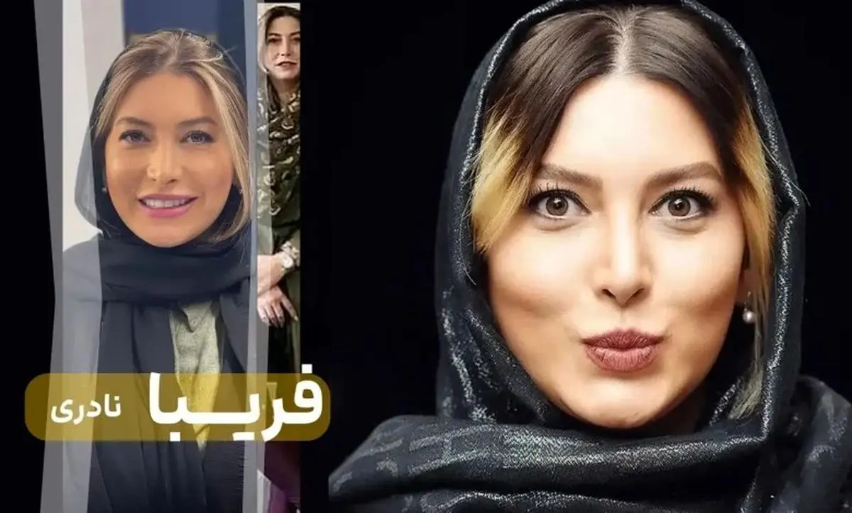 تصاویر قبل و بعد از عمل زیبایی فریبا نادری؛ تغییرات چشم‌نواز و جدیدترین ظاهر بازیگر محبوب
