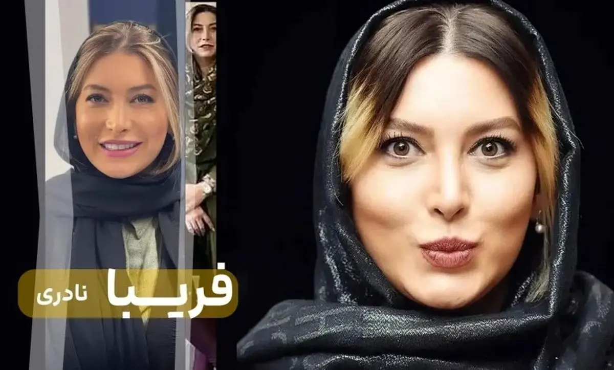 تصاویر قبل و بعد از عمل زیبایی فریبا نادری؛ تغییرات چشم‌نواز و جدیدترین ظاهر بازیگر محبوب
