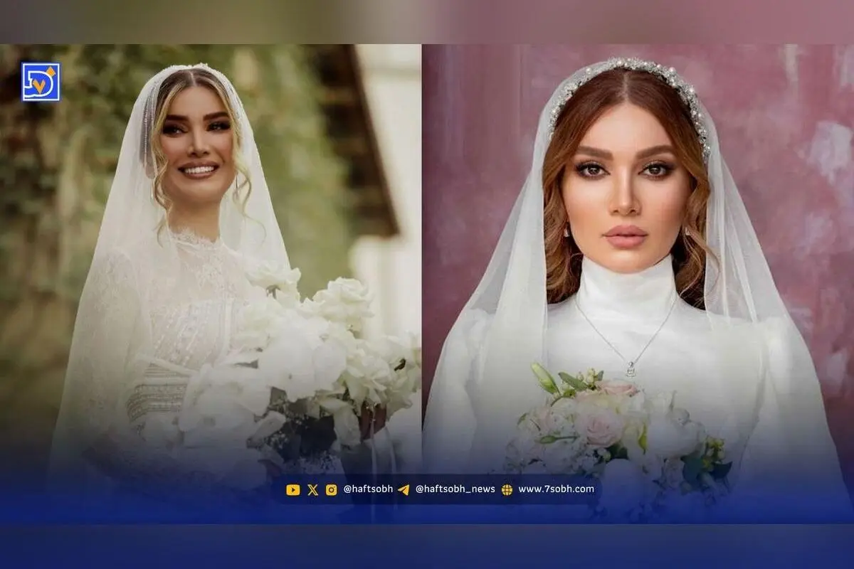 تفاوت چشمگیر ظاهر متین ستوده قبل و بعد عمل زیبایی؛ واکنش‌ها و پشیمانی بازیگر محبوب سریال لیسانسه‌ها