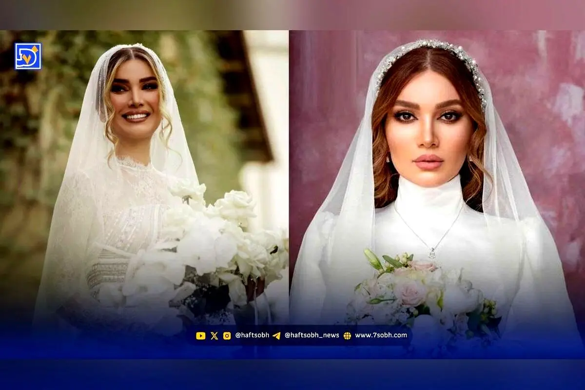 تفاوت چشمگیر ظاهر متین ستوده قبل و بعد عمل زیبایی؛ واکنش‌ها و پشیمانی بازیگر محبوب سریال لیسانسه‌ها