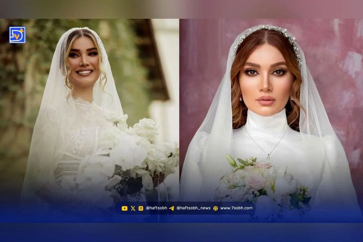 تفاوت چشمگیر ظاهر متین ستوده قبل و بعد عمل زیبایی؛ واکنشها و پشیمانی بازیگر محبوب سریال لیسانسهها