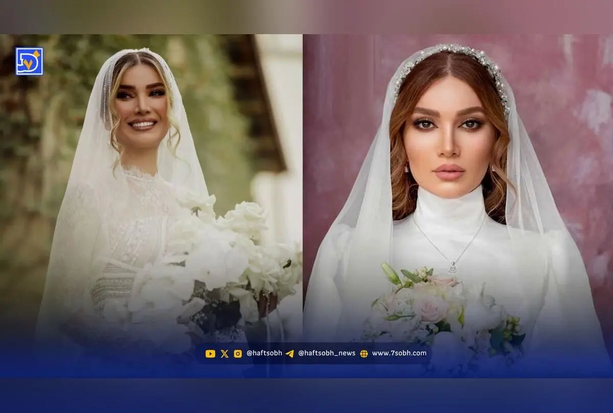تفاوت چشمگیر ظاهر متین ستوده قبل و بعد عمل زیبایی؛ واکنش‌ها و پشیمانی بازیگر محبوب سریال لیسانسه‌ها