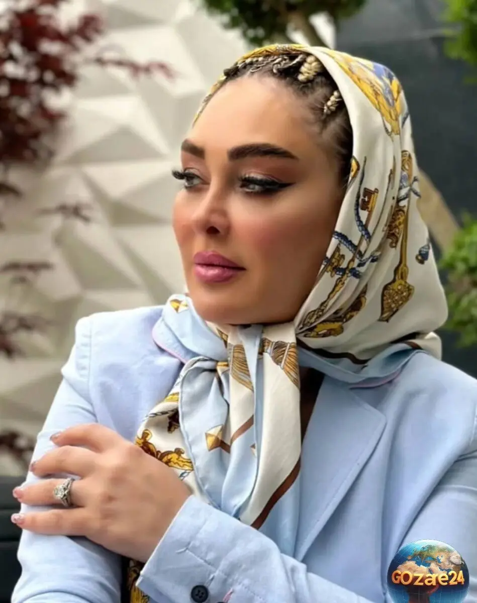 نتیجه شگفت‌انگیز تزریق بوتاکس و فیلرهای صورت الهام حمیدی؛ قبل و بعد در اینستاگرام