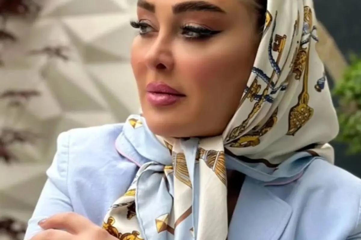 نتیجه شگفت‌انگیز تزریق بوتاکس و فیلرهای صورت الهام حمیدی؛ قبل و بعد در اینستاگرام