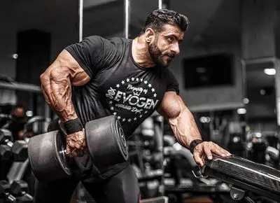 مگه هادی چوپان مو نداشت؟ تصاویر منتشر شده از کاشت موی گرگ پارسی در ترکیه