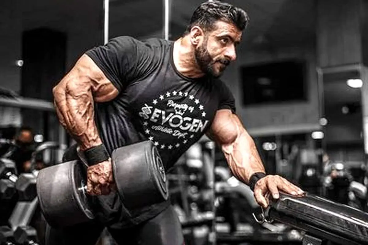 مگه هادی چوپان مو نداشت؟ تصاویر منتشر شده از کاشت موی گرگ پارسی در ترکیه
