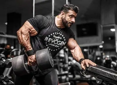 مگه هادی چوپان مو نداشت؟ تصاویر منتشر شده از کاشت موی گرگ پارسی در ترکیه