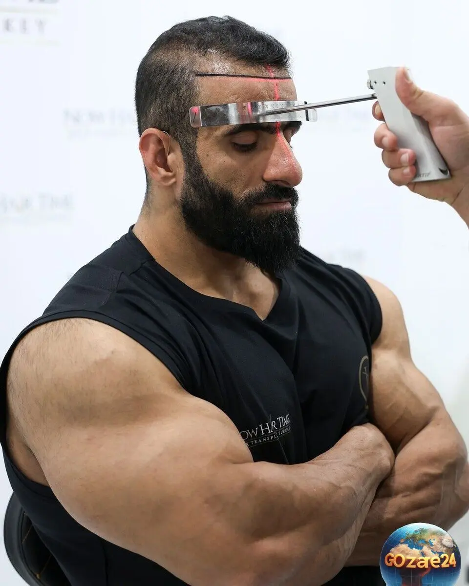 هادی چوپان در مسیر زیبایی و موفقیت‌های جهانی؛ از روستای فارس تا مرکز تخصصی زیبایی در ترکیه