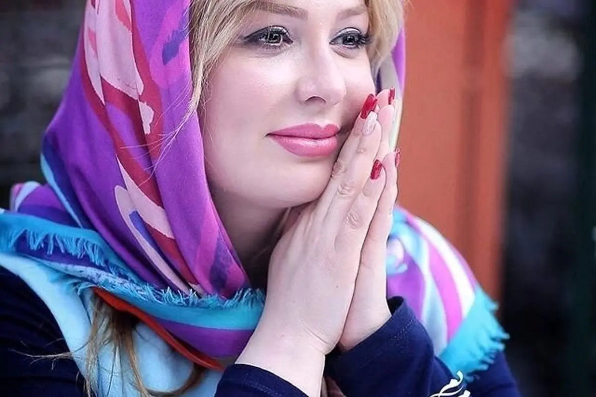 تغییر شگفتانگیز چهره نیوشا ضیغمی قبل و بعد از عمل زیبایی | تصاویر جدید و تحلیل کامل