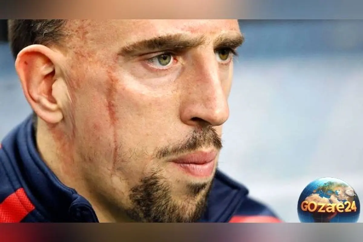 داستان زندگی ستاره فوتبال که از فقر و زخم صورت تا قله‌های موفقیت رسید | ریبری و معجزه فوتبال