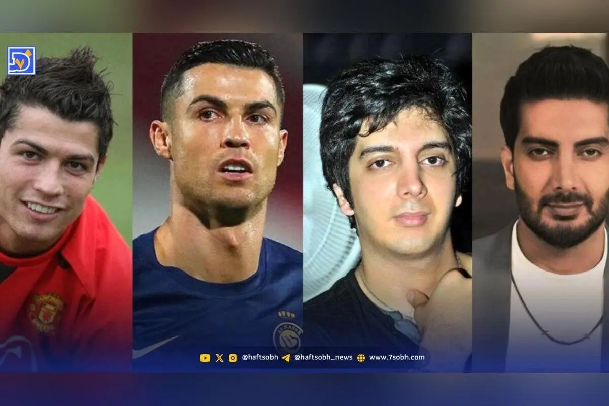 تاثیر ثروت بر تغییرات چهره ستاره‌ها: قبل و بعد از شهرت در ایران و جهان