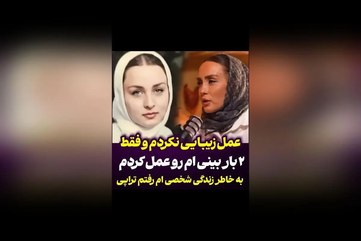 حدیث فولادوند: تنها دو عمل بینی انجام دادم و برای سلامت روانم به تراپی نیاز داشتم