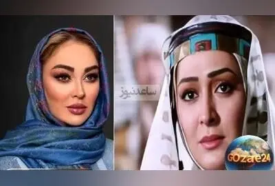 الهام حمیدی: مخالف فیلر و عمل‌های زیبایی دفرمه‌کننده؛ بازیگری که روند طبیعی چهره‌اش را ترجیح می‌دهد