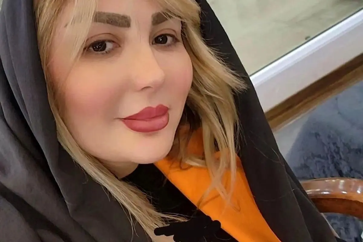 تصویر لورفته از صورت زخم و کبود نیوشا ضیغمی در پشت صحنه فیلم؛ ماجرای جنجالی و جزئیات جدید