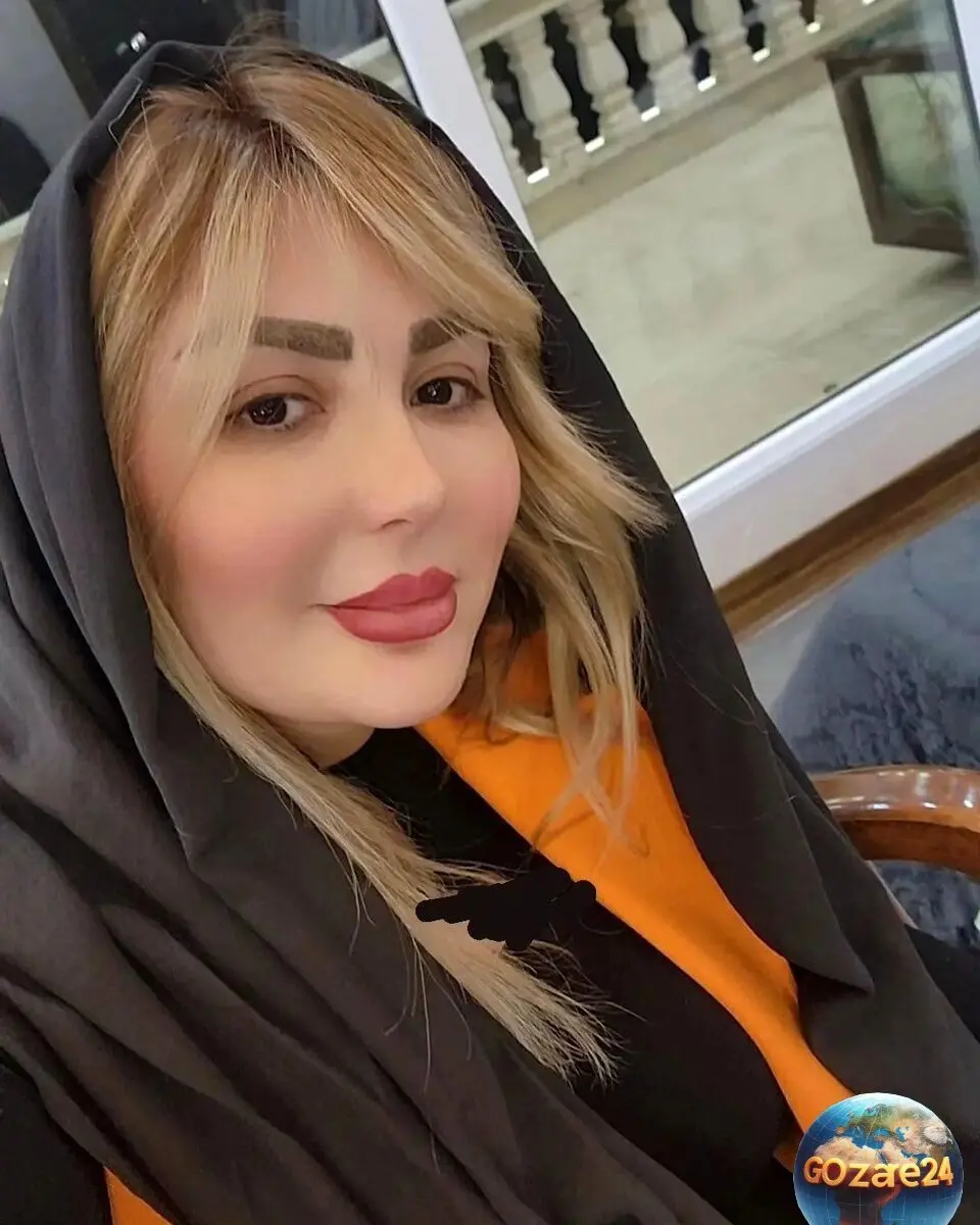 تصویر لورفته از صورت زخم و کبود نیوشا ضیغمی در پشت صحنه فیلم؛ ماجرای جنجالی و جزئیات جدید
