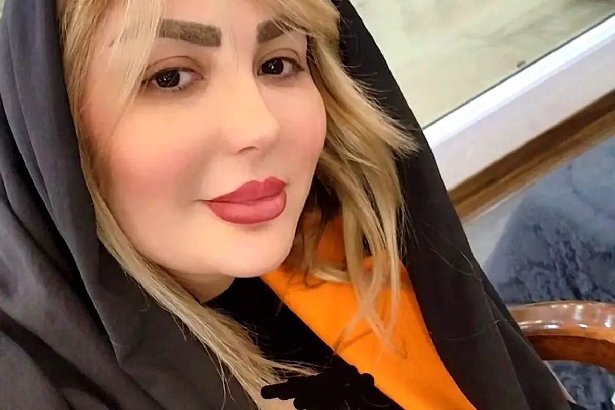 تصویر لورفته از صورت زخم و کبود نیوشا ضیغمی در پشت صحنه فیلم؛ ماجرای جنجالی و جزئیات جدید
