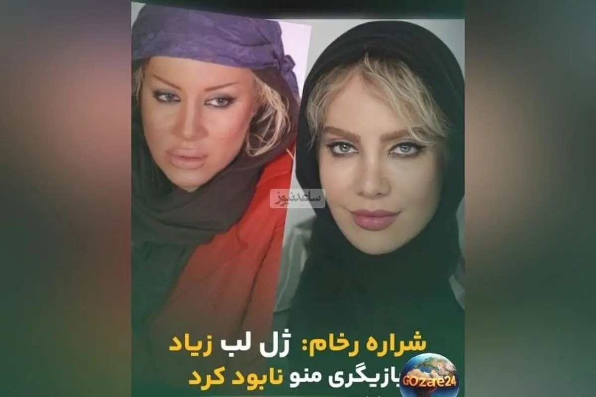 شراره رخام: از بازیگری نابودشده با ژل لب به گرایش نچرال و طبیعی بازگشتم