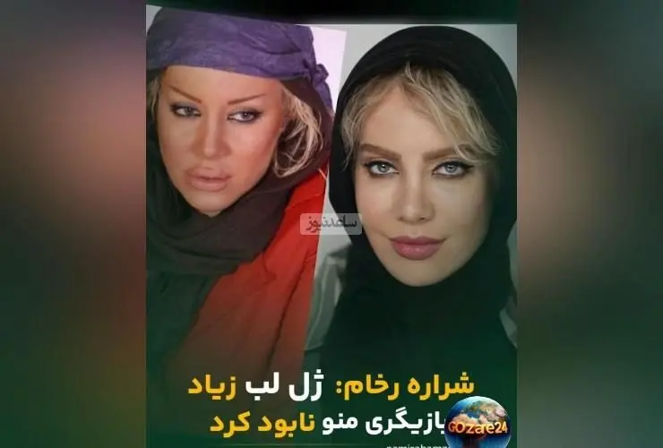 شراره رخام: از بازیگری نابودشده با ژل لب به گرایش نچرال و طبیعی بازگشتم