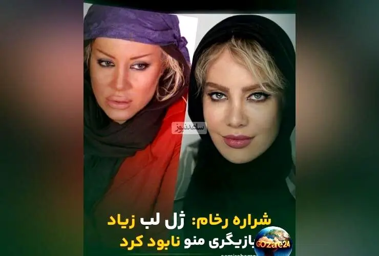 شراره رخام: از بازیگری نابودشده با ژل لب به گرایش نچرال و طبیعی بازگشتم