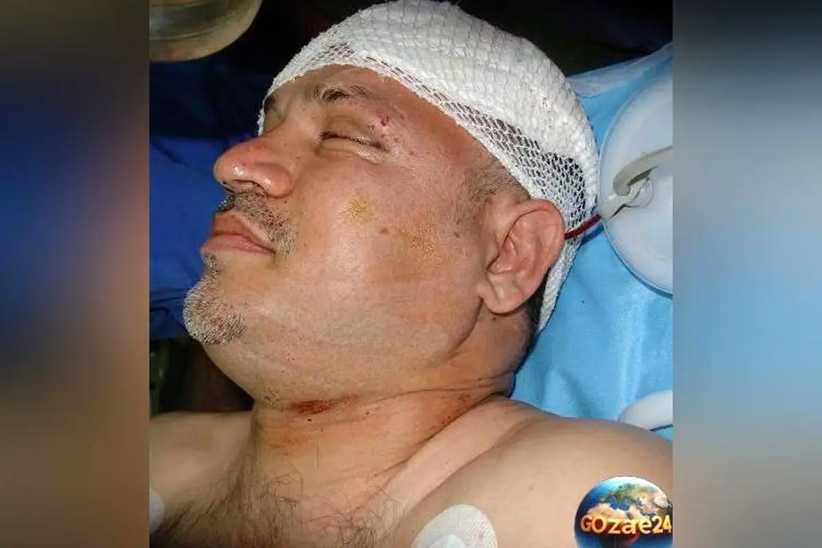 نجات معجزه‌آسا و خاطره تلخ تصادف علی دایی: وقتی ماشین واژگون شد و او از مرگ نجات یافت