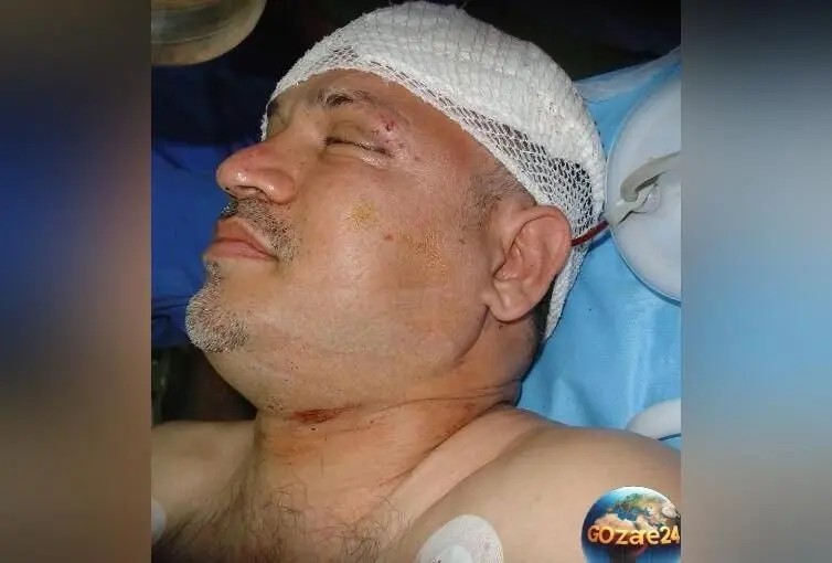نجات معجزه‌آسا و خاطره تلخ تصادف علی دایی: وقتی ماشین واژگون شد و او از مرگ نجات یافت
