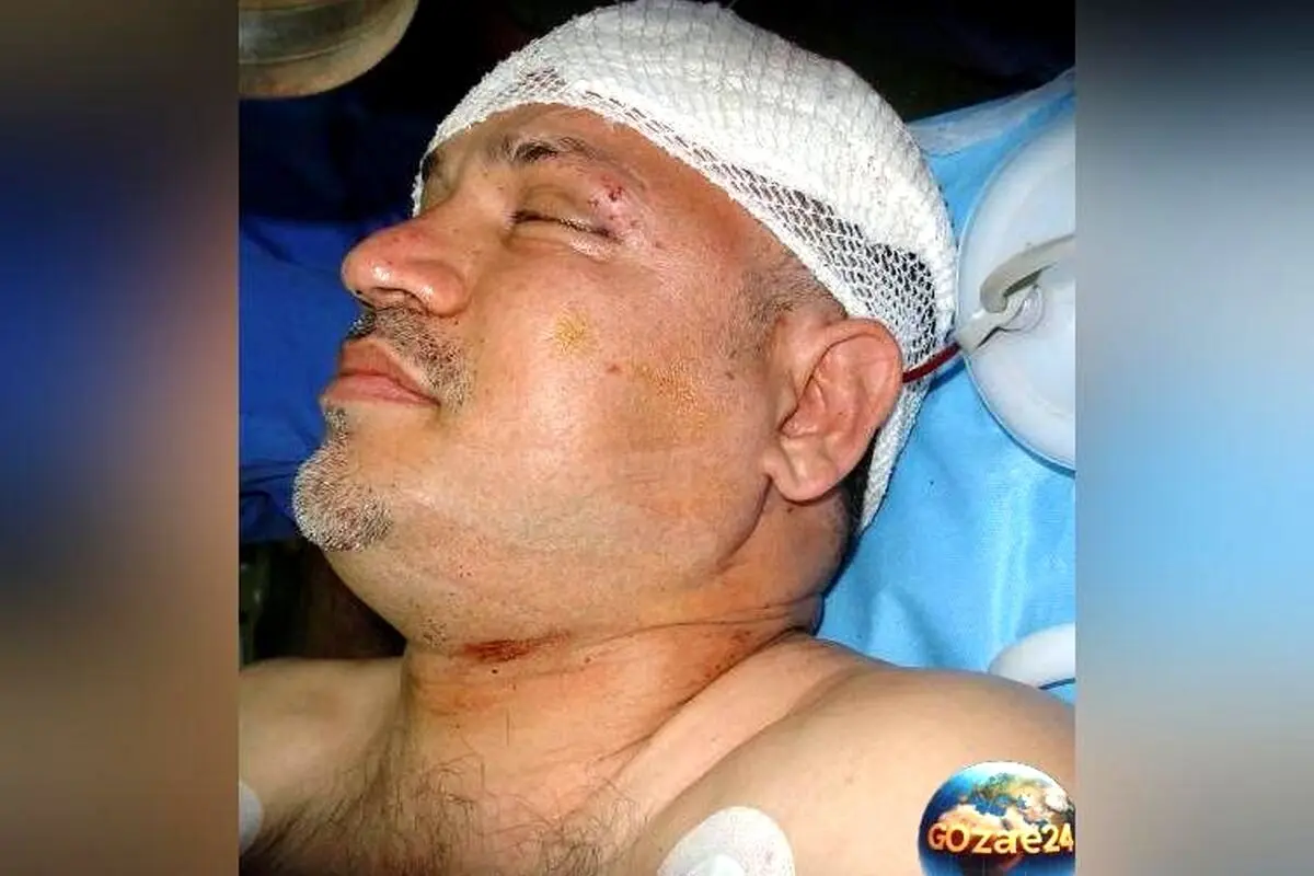 نجات معجزه‌آسا و خاطره تلخ تصادف علی دایی: وقتی ماشین واژگون شد و او از مرگ نجات یافت