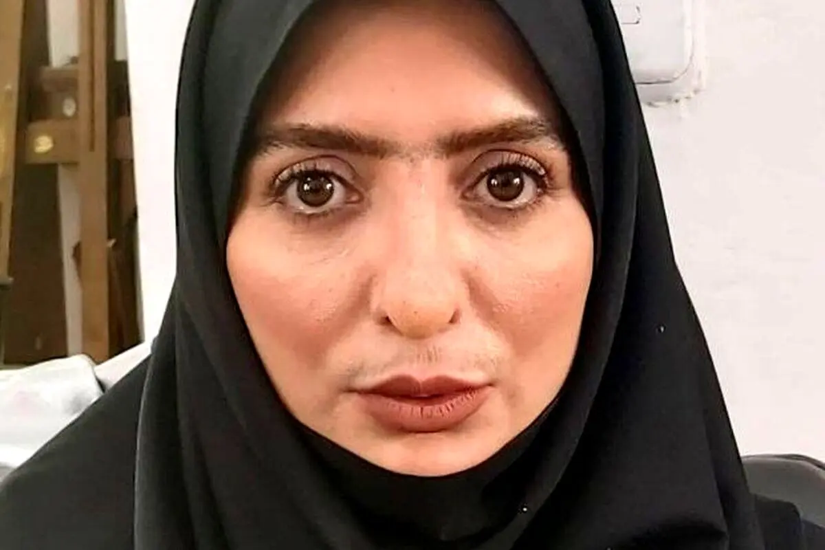 رویا میرعلمی از حادثه تلخ در تئاتر و شکستگی پا و فلج شدن 6 ماهه صحبت می‌کند