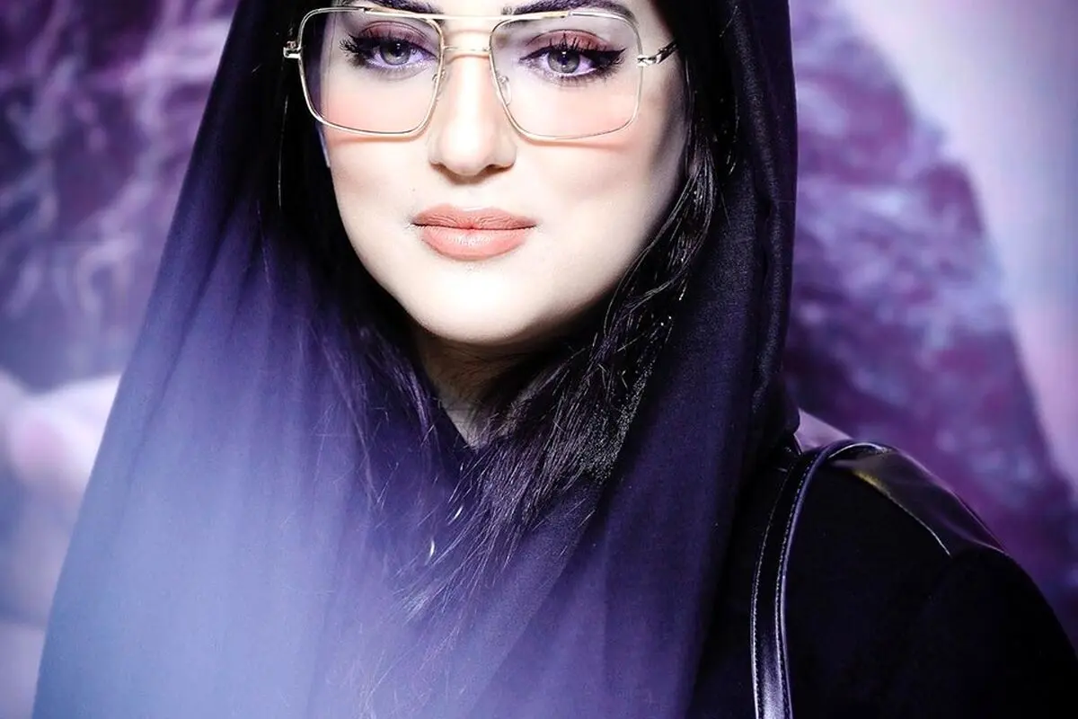 هلیا امامی با تزریق و عمل‌های زیبایی، تغییر چهره و جدیدترین تصاویرش را در اینستاگرام منتشر کرد