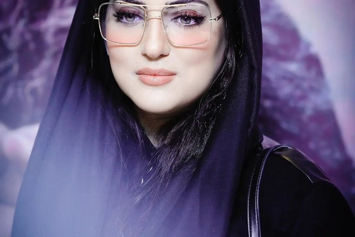 هلیا امامی با تزریق و عمل‌های زیبایی، تغییر چهره و جدیدترین تصاویرش را در اینستاگرام منتشر کرد