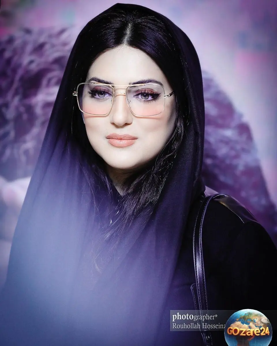 هلیا امامی با تزریق و عمل‌های زیبایی، تغییر چهره و جدیدترین تصاویرش را در اینستاگرام منتشر کرد