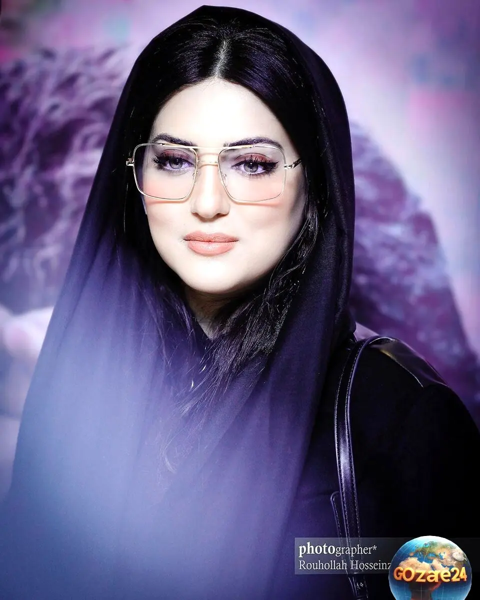 هلیا امامی با تزریق و عمل‌های زیبایی، تغییر چهره و جدیدترین تصاویرش را در اینستاگرام منتشر کرد