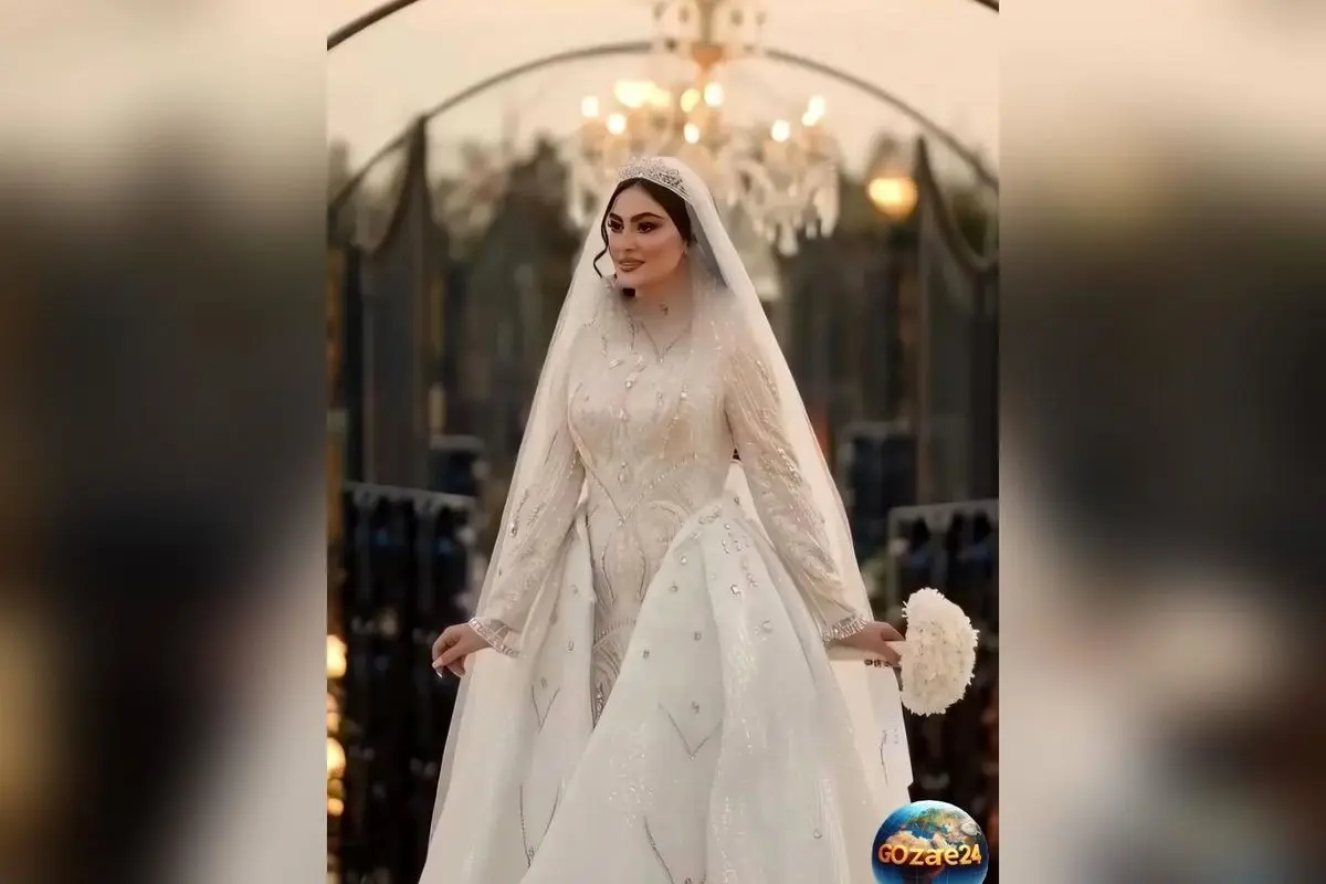 مریم مومن تازه عروس سینمای ایران زیر تیغ جراحی دندان و ایمپلنت + فیلم لحظه‌ها