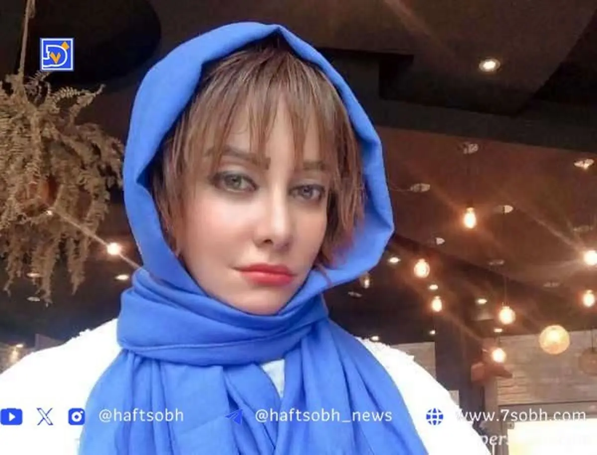 تحول عجیب و قابل توجه چهره شراره رخام پس از چاقی | بیوگرافی و تغییرات ظاهری بازیگر سرشناس