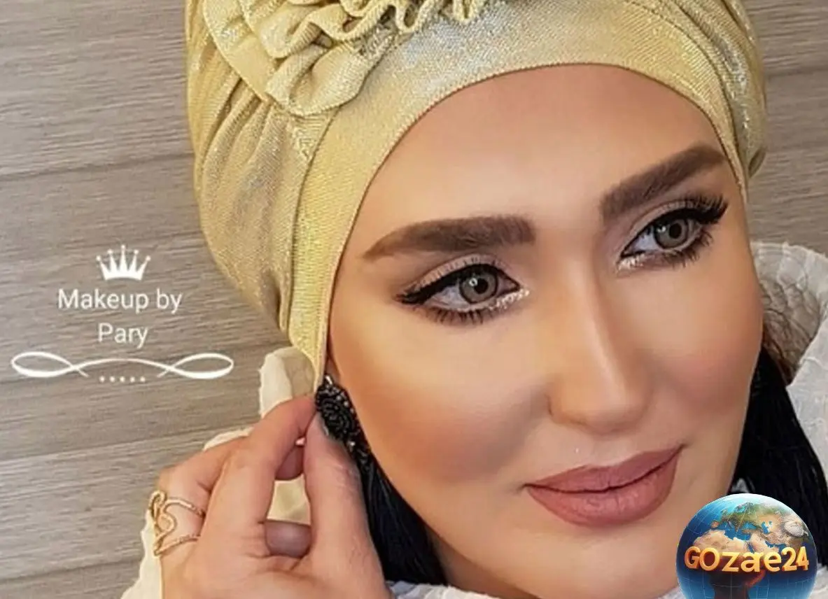 چهره متفاوت زهره فکور در اثر عمل‌های زیبایی متوالی؛ واکنش‌ها و تحلیل‌ها