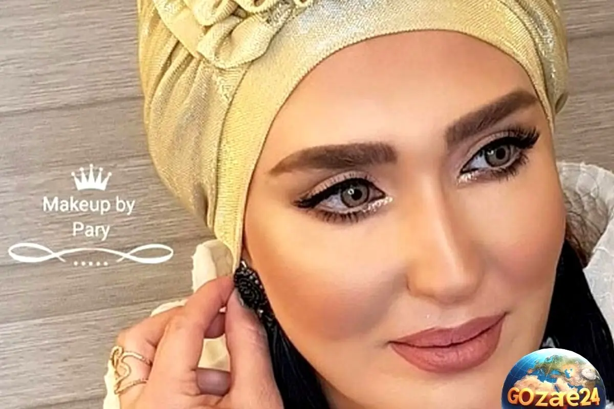 چهره متفاوت زهره فکور در اثر عمل‌های زیبایی متوالی؛ واکنش‌ها و تحلیل‌ها