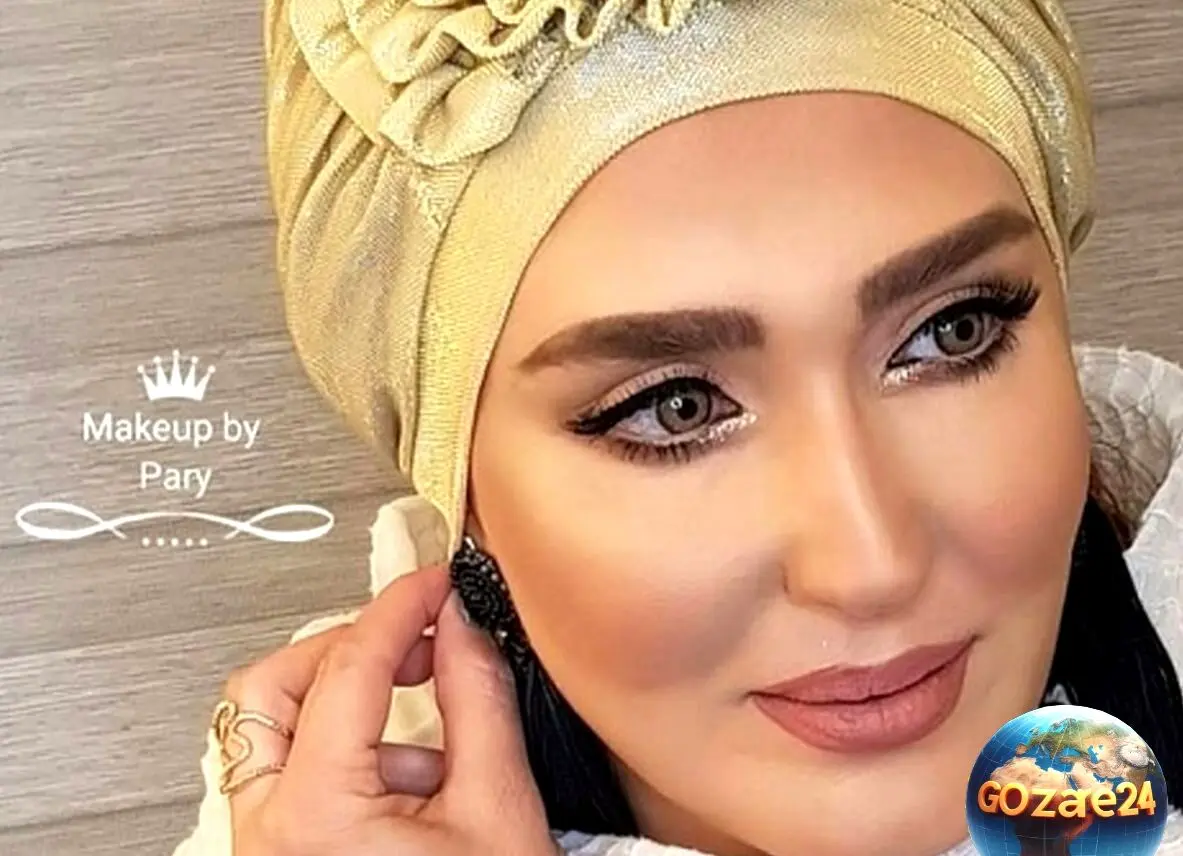 چهره متفاوت زهره فکور در اثر عمل‌های زیبایی متوالی؛ واکنش‌ها و تحلیل‌ها