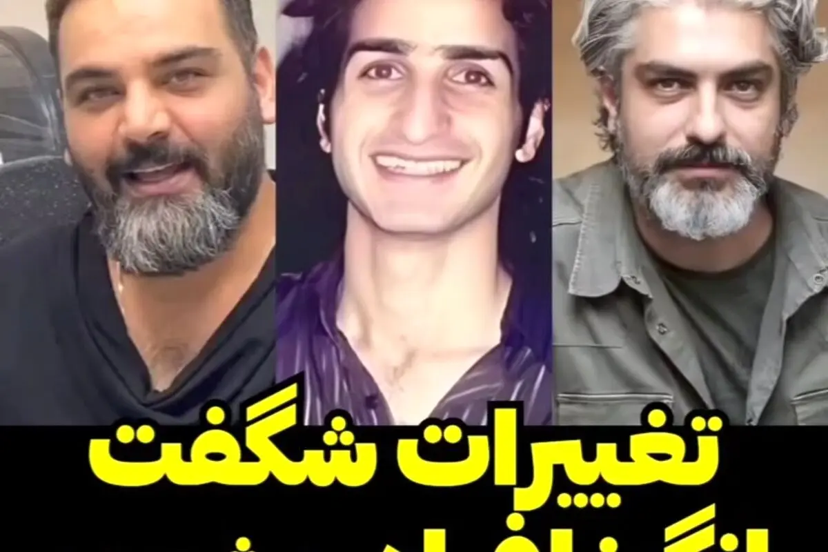 تغییر شگفت‌انگیز چهره افراد مشهور قبل و بعد از رسیدن به شهرت 