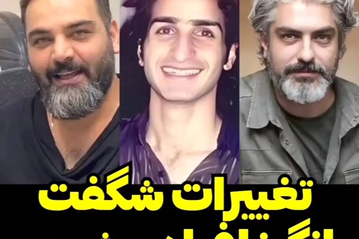 تغییر شگفتانگیز چهره افراد مشهور قبل و بعد از رسیدن به شهرت