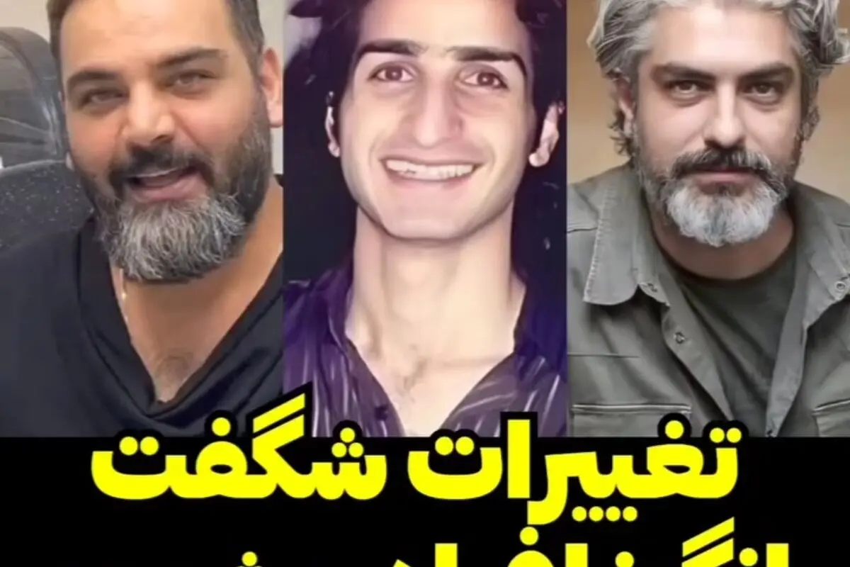 تغییر شگفت‌انگیز چهره افراد مشهور قبل و بعد از رسیدن به شهرت 